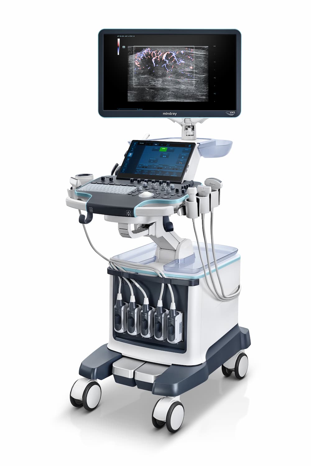 Resona Ultrasound System